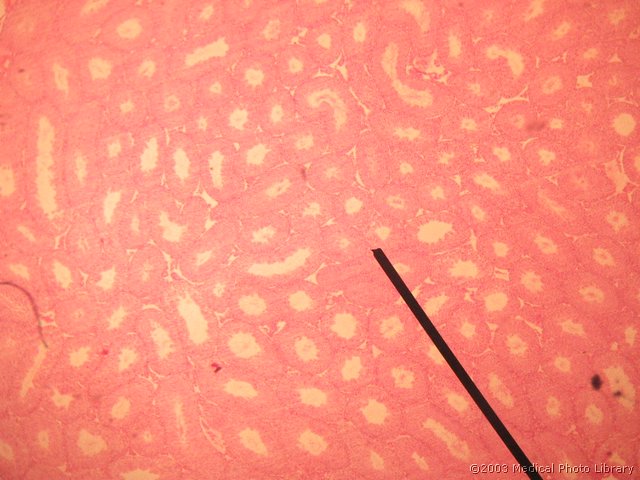 17 Testis in epididimis miske.jpg