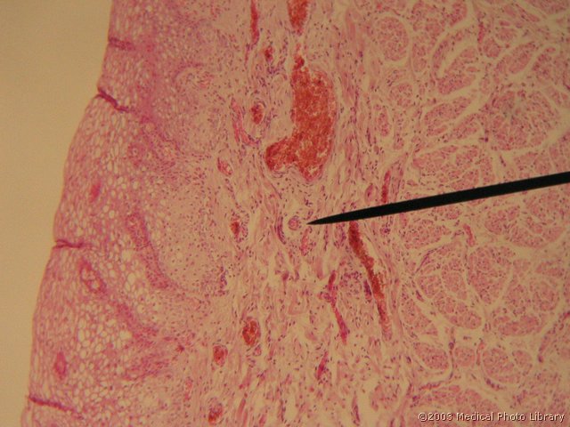 084 5 Arteriola.jpg